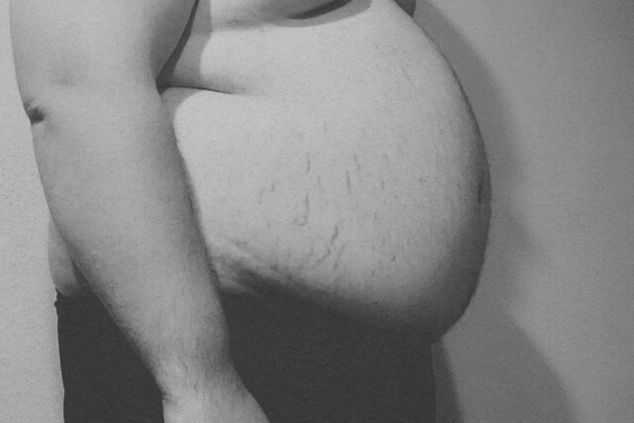 Side profile of a shirtless person with a protruding belly, displaying stretch marks and sagging skin in a dimly lit room.