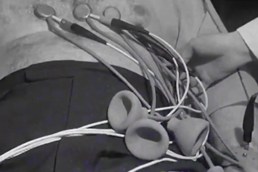 Close-up of a man's torso with several medical electrode pads and suction cups attached to his chest, likely during a heart monitoring procedure.