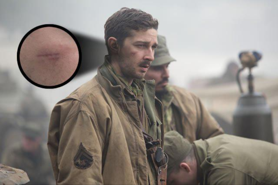A soldier with a cut on his face stands in a war zone wearing a dirty uniform, with a zoomed inset of a cheek scar.
