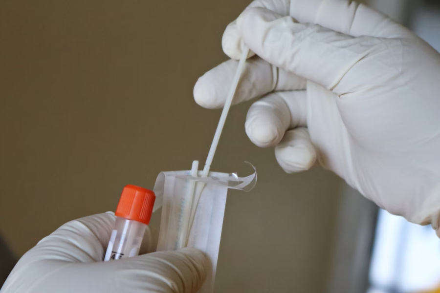 DNA Test SWAB